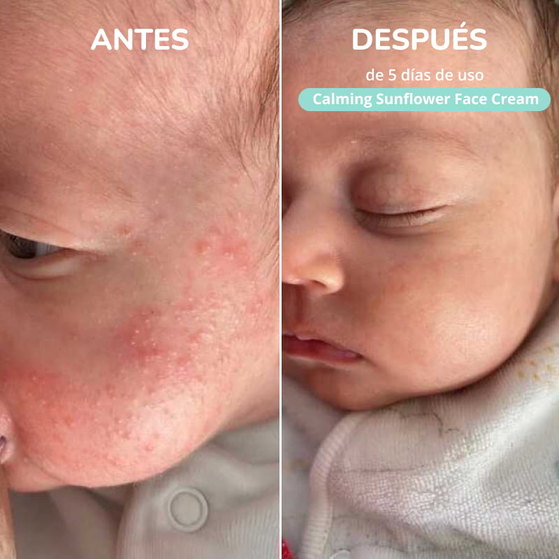 Crema calmante Granitos y Rojeces – Freshly - Imagen 5